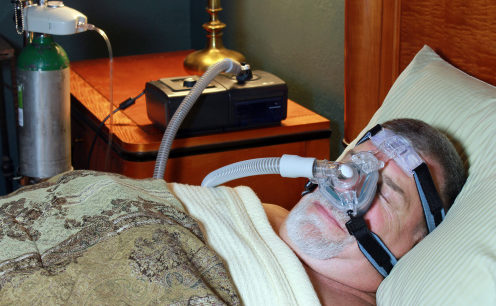 Sleep apnea