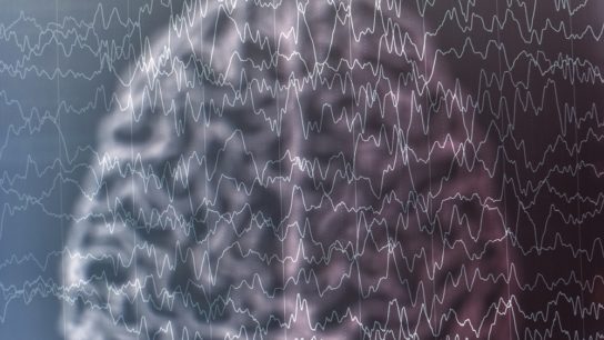 EEG of brain wave