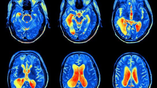 functional MRI brain