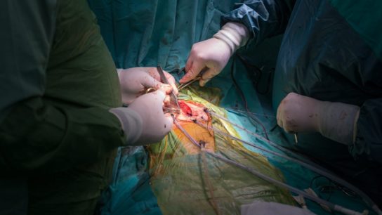 Heart surgery in hospital