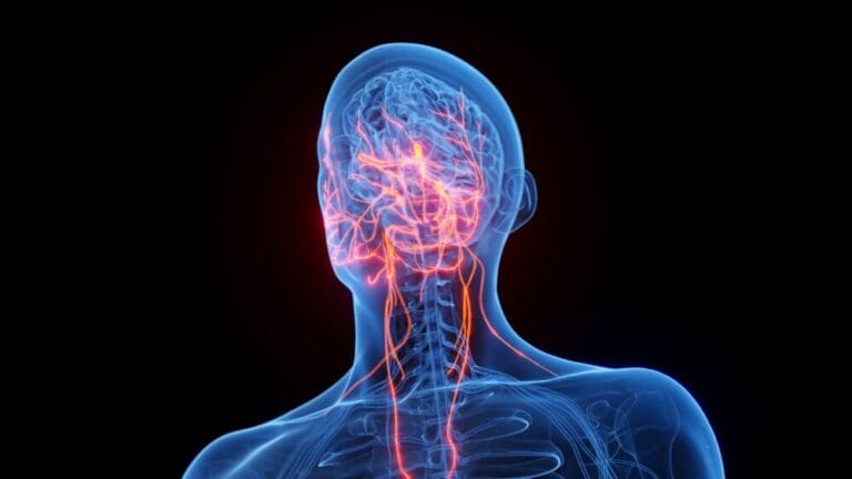 Vagus Nerve Stimulation for Rheumatoid Arthritis
