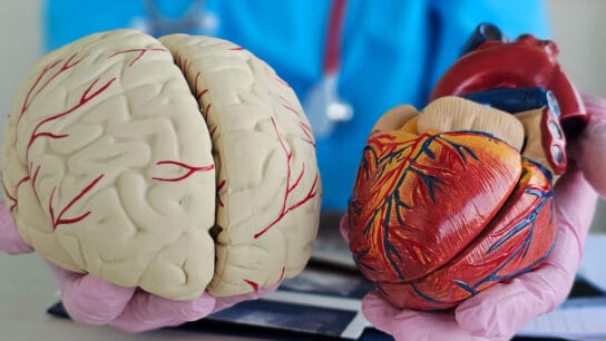 atrial fibrillation and all cause dementia