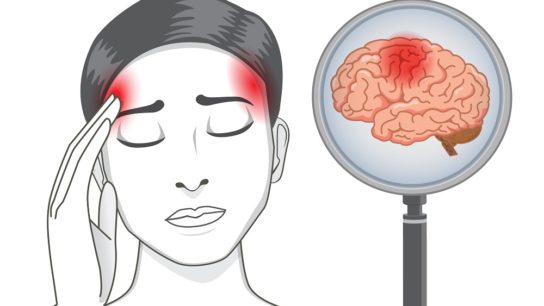 woman with headache symptoms