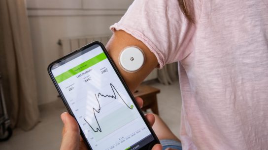 Continuous Glucose Monitoring