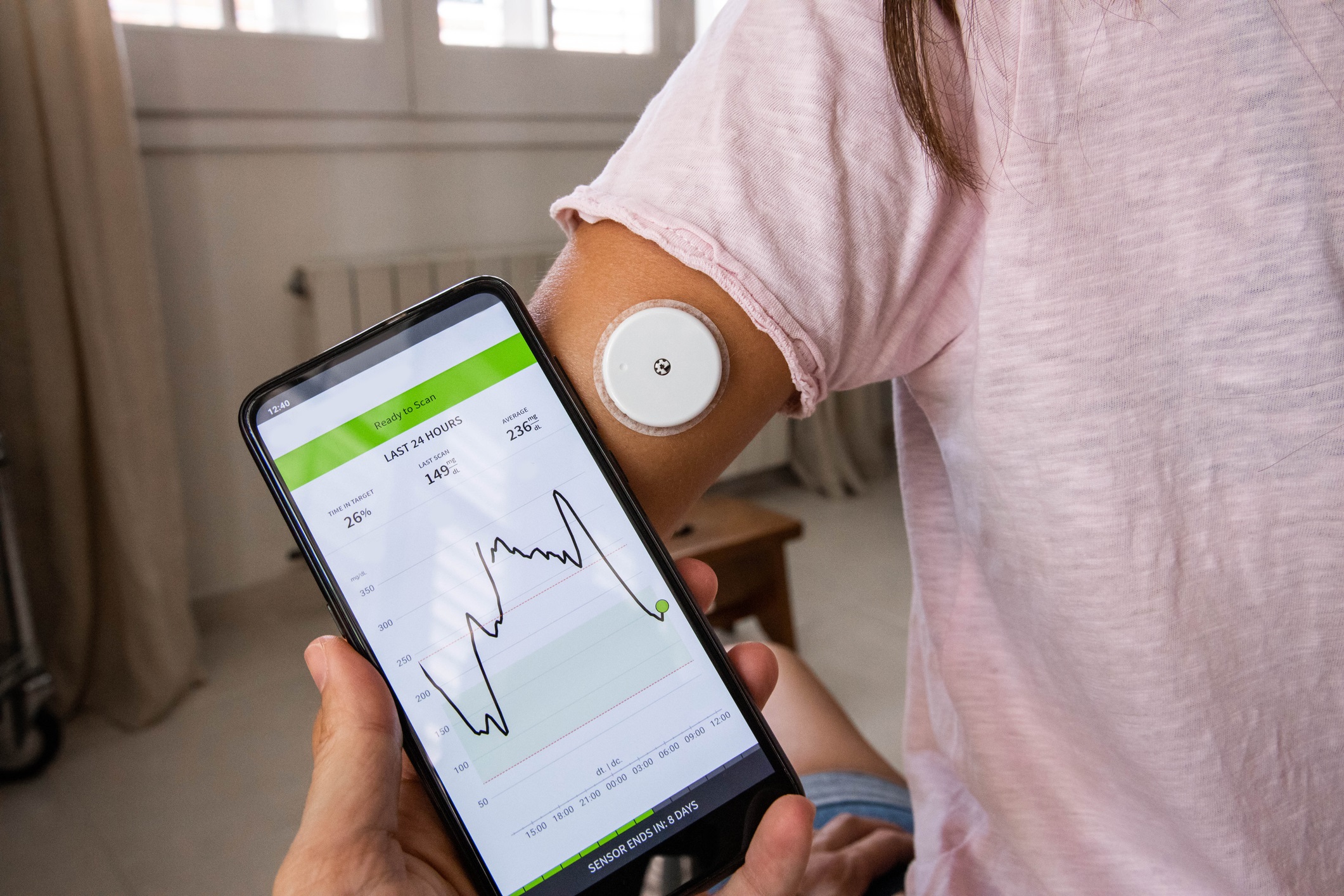 Continuous Glucose Monitoring