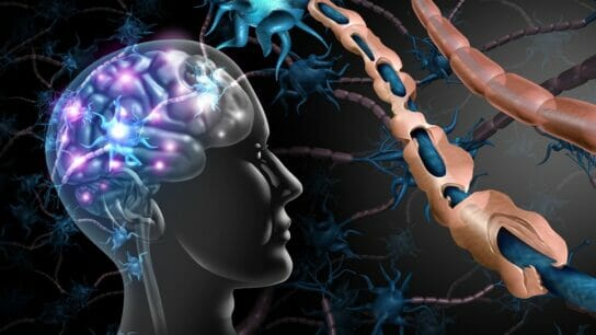 multiple-sclerosis-3D-illustration