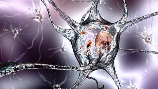 illustration of a Parkinson neuron