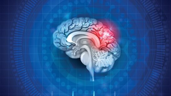 Image of damage to the brain