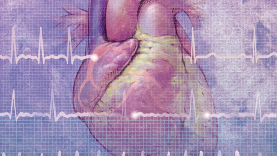 AtrialFibrillationWithHeart_MI_01AFTFMK_cropped