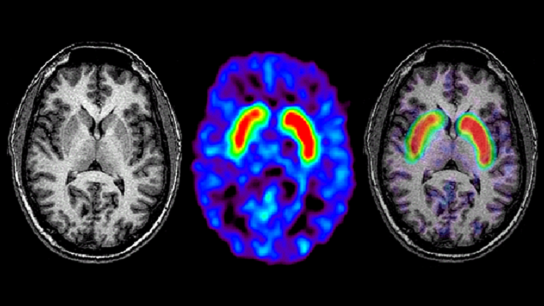 axial section normal brain scan